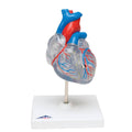 Classic Heart with Conducting System S870